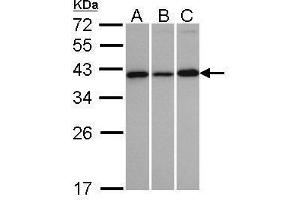 WB Image Sample(30 ug whole cell lysate) A:H1299 B:HeLa S3 C:MOLT4 , 12% SDS PAGE antibody diluted at 1:1000 (VTA1 antibody  (Center))