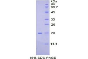 SDS-PAGE analysis of Pig BMP2 Protein. (BMP2 Protein)