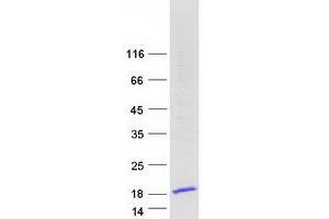 Western Blotting (WB) image for High Mobility Group Nucleosomal Binding Domain 3 (HMGN3) (Transcript Variant 2) protein (Myc-DYKDDDDK Tag) (ABIN2722878)