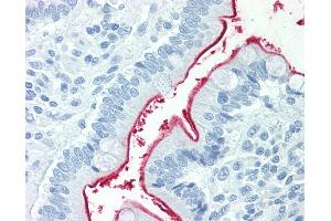 Anti-NPC1L1 antibody IHC staining of human small intestine. (NPC1L1 antibody  (Internal Region))