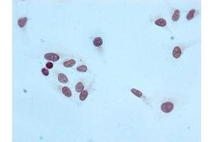 Immunocytochemistry analysis of ABIN7127312 diluted at 1:100 and staining in Hela cells performed on a Leica BondTM system. (Recombinant HIST1H4A antibody  (3meLys20))