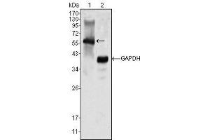Western Blot showing MATK antibody used against K562 cell lysate (1). (MATK antibody)