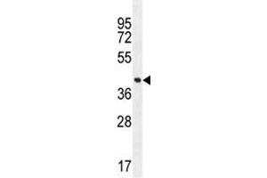 FOXA2 antibody western blot analysis in MDA-MB231 lysate. (FOXA2 antibody  (AA 128-157))