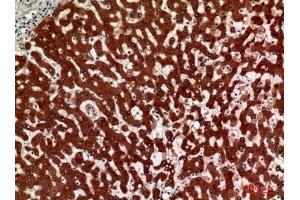 Immunohistochemical analysis of paraffin-embedded human-liver, antibody was diluted at 1:100.