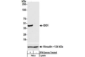 Western Blotting (WB) image for anti-Indoleamine 2,3-Dioxygenase 1 (IDO1) (AA 1-403) antibody (ABIN7449662)