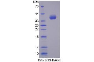 SDS-PAGE (SDS) image for Arachidonate 12-Lipoxygenase, 12R Type (ALOX12B) (AA 389-701) protein (His tag) (ABIN4989709)