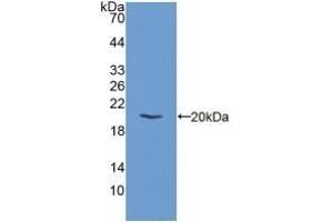 Detection of Recombinant EIF2aK3, Mouse using Polyclonal Antibody to Eukaryotic Translation Initiation Factor 2 Alpha Kinase 3 (EIF2aK3) (PERK antibody  (AA 973-1114))