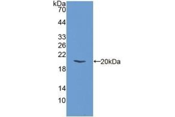 PERK anticorps  (AA 973-1114)