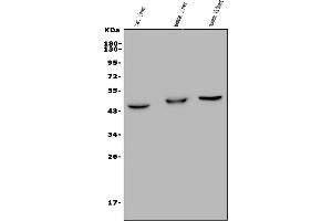 Western blot analysis of GPCR TGR5/GPBAR1 using anti-GPCR TGR5/GPBAR1 antibody (ABIN7602825).