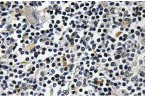 Immunohistochemistry (IHC) analyzes of p-Op18 antibody in paraffin-embedded human thymus gland tissue. (Stathmin 1 antibody  (pSer16))