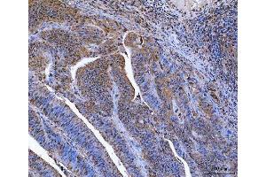 IHC analysis of Glutathione Reductase using anti-Glutathione Reductase antibody (ABIN5693151). (Glutathione Reductase antibody  (AA 256-522))