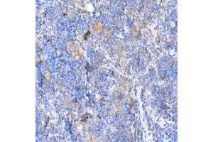 Immunohistochemistry of paraffin-embedded mouse spleen using M Rabbit pAb (ABIN3021414, ABIN3021415, ABIN3021416 and ABIN6215021) at dilution of 1:500 (40x lens). (MAGED1 antibody  (AA 635-834))