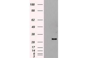 Western Blotting (WB) image for anti-Hematopoietically Expressed Homeobox (HHEX) (AA 100-270) antibody (ABIN1490798) (HHEX antibody  (AA 100-270))