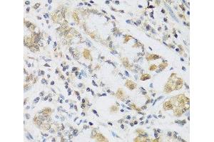 Immunohistochemistry of paraffin-embedded Human stomach using RETN Polyclonal Antibody at dilution of 1:100 (40x lens). (Resistin antibody)