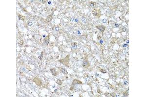 Immunohistochemistry of paraffin-embedded Rat brain using VPS37A Polyclonal Antibody at dilution of 1:100 (40x lens). (VPS37A antibody)