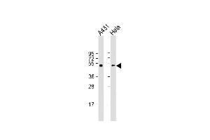 All lanes : Anti-p53 Antibody (S15) at 1:2000 dilution Lane 1: A431 whole cell lysate Lane 2: Hela whole cell lysate Lysates/proteins at 20 μg per lane. (p53 antibody  (AA 1-30))
