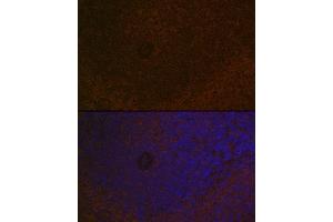 Immunofluorescence analysis of rat spleen using C Rabbit mAb (ABIN7266125) at dilution of 1:100 (40x lens). (CARD11 antibody)
