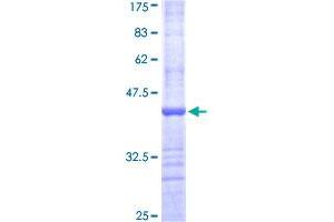 GUCY2D Protein (AA 521-630) (GST tag)