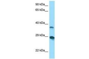 Image no. 1 for anti-V-Set and Immunoglobulin Domain-Containing Protein 4 (VSIG4) (AA 40-89) antibody (ABIN6748427) (VSIG4 antibody  (AA 40-89))