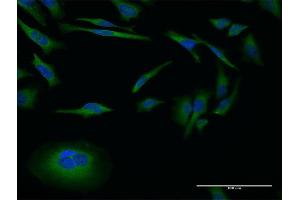 Immunofluorescence of monoclonal antibody to MMP26 on HeLa cell.