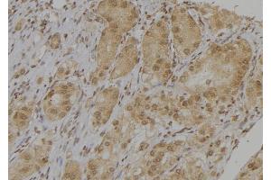 Immunohistochemistry (IHC) image for anti-CD38 (Internal Region) antibody (ABIN6260617)