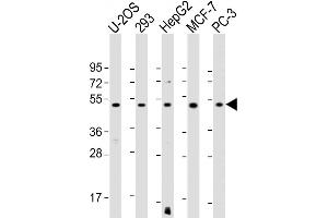 All lanes : Anti-EEF1A1P5 Antibody (C-Term) at 1:1000-1:2000 dilution Lane 1: U-2OS whole cell lysate Lane 2: 293 whole cell lysate Lane 3: HepG2 whole cell lysate Lane 4: MCF-7 whole cell lysate Lane 5: PC-3 whole cell lysate Lysates/proteins at 20 μg per lane. (EEF1A1P5 antibody  (AA 430-462))