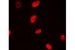 Immunofluorescent analysis of NSUN6 staining in MCF7 cells. (NSUN6 antibody)