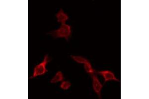 ABIN6266750 staining HeLa by IF/ICC. (NXF1 antibody  (N-Term))
