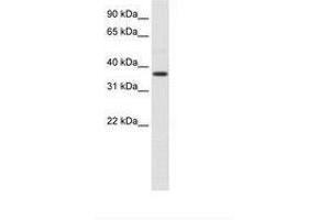 Image no. 1 for anti-alpha-2-HS-Glycoprotein (AHSG) (N-Term) antibody (ABIN6736103) (Fetuin A antibody  (N-Term))