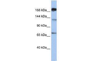 WB Suggested Anti-MTR  Antibody Titration: 0. (MTR antibody  (C-Term))