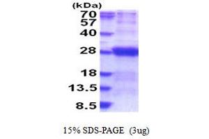 SDS-PAGE (SDS) image for Dynactin 6 (DCTN6) (AA 1-190) protein (His tag) (ABIN5853904) (DCTN6 Protein (AA 1-190) (His tag))