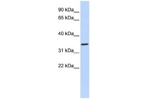 WB Suggested Anti-ZNF660 Antibody Titration:  0. (ZNF660 antibody  (N-Term))