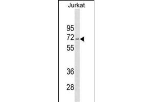JRKL Antibody (C-term) (ABIN1537295 and ABIN2849486) western blot analysis in Jurkat cell line lysates (35 μg/lane). (JRKL antibody  (C-Term))