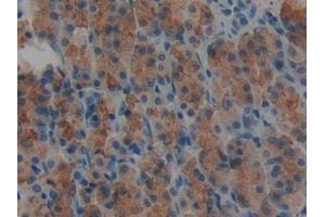 Immunohistochemistry (IHC) image for anti-Agrin (AGRN) (AA 1206-1475) antibody (ABIN7442237)