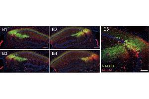 Representative confocal serial sections of mouse hippocampus infected with M1-EGFP (green) and stained with RGS14 ((ABIN1304934), 1:500, red). (RGS14 antibody  (AA 1-544))