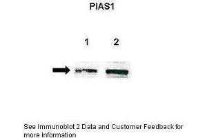 Lanes:   Lane 1: Untreated human U251 lysate Lane 2: IL-1beta treated human U251 lysate  Primary Antibody Dilution:   1:500  Secondary Antibody:   Anti-rabbit-HRP  Secondary Antibody Dilution:   1:500  Gene Name:   PIAS1  Submitted by:   Anonymous (PIAS1 antibody  (Middle Region))