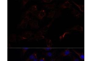 Immunofluorescence analysis of C6 cells using SEPT8 Polyclonal Antibody at dilution of 1:100. (Septin 8 antibody)