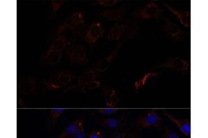 Immunofluorescence analysis of C6 cells using SEPT8 Polyclonal Antibody at dilution of 1:100.