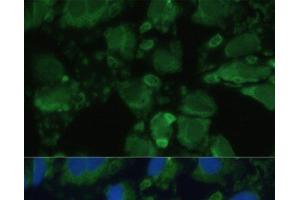 Immunofluorescence analysis of U-2 OS cells using ENO1 Polyclonal Antibody at dilution of 1:100. (ENO1 antibody)