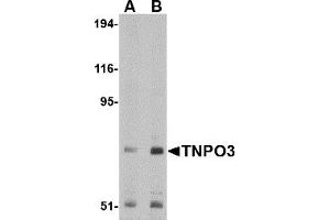 Western Blotting (WB) image for anti-Transportin 3 (TNPO3) (N-Term) antibody (ABIN1031633) (Transportin 3 antibody  (N-Term))