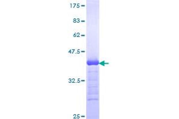 Phospholipase C beta 1 Protein (AA 1107-1216) (GST tag)