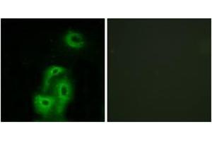Immunofluorescence analysis of A549 cells, using 5-HT-2A Antibody. (HTR2A antibody  (AA 422-471))