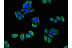 Immunofluorescent analysis of PC-3 cells using ABIN7175600 at dilution of 1:100 and Alexa Fluor 488-congugated AffiniPure Goat Anti-Rabbit IgG(H+L) (CACNB4 antibody  (AA 1-217))