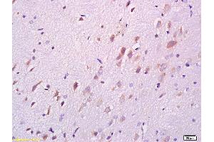 Formalin-fixed and paraffin embedded rat brain labeled with Anti DARPP32 Polyclonal Antibody, Unconjugated (ABIN680323) at 1:200 followed by conjugation to the secondary antibody and DAB staining (DARPP32 antibody  (AA 51-150))