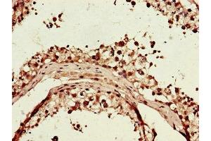 Immunohistochemistry of paraffin-embedded human testis tissue using ABIN7156464 at dilution of 1:100 (CD11b antibody  (AA 46-150))