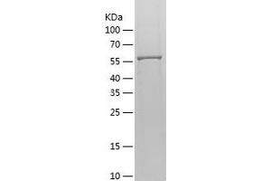Western Blotting (WB) image for Adenylate Kinase 5 (AK5) (AA 1-562) protein (His tag) (ABIN7121721) (Adenylate Kinase 5 Protein (AK5) (AA 1-562) (His tag))