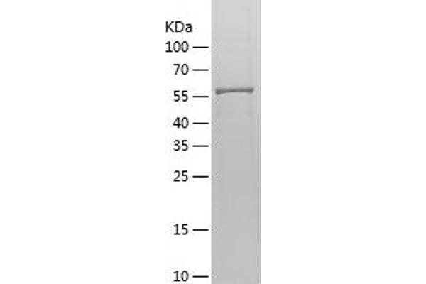 Adenylate Kinase 5 Protein (AK5) (AA 1-562) (His tag)