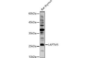 Western blot analysis of extracts of Rat thymus, using L antibody (ABIN7268342) at 1:1000 dilution.