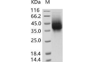 Western Blotting (WB) image for Respiratory Syncytial Virus Glycoprotein (RSV G) protein (His tag) (ABIN7198761) (Respiratory Syncytial Virus Glycoprotein (RSV G) protein (His tag))