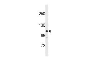 Western blot analysis in SK-BR-3 cell line lysates (35ug/lane). (MYLK antibody  (N-Term))